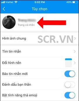 Hiển Thị sđt Zalo