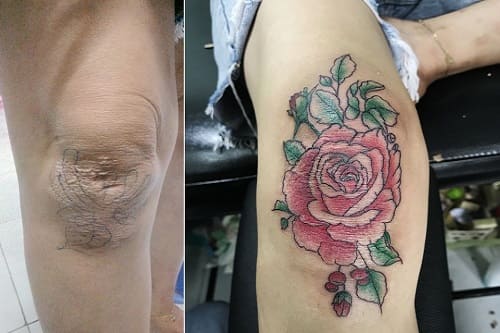 mẫu hình tattoo che sẹo cho nữ