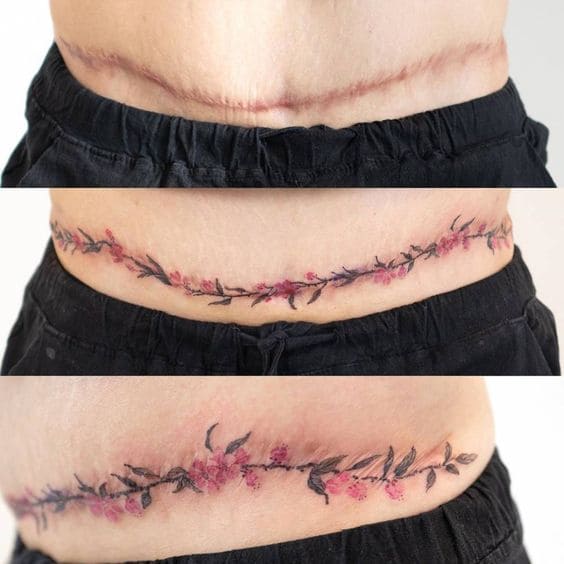 mẫu tattoo hình nhành hoa dọc theo vết mổ ở bụng