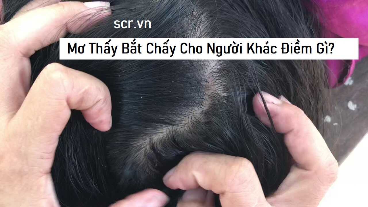 Mo Thay Bat Chay Cho Nguoi Khac