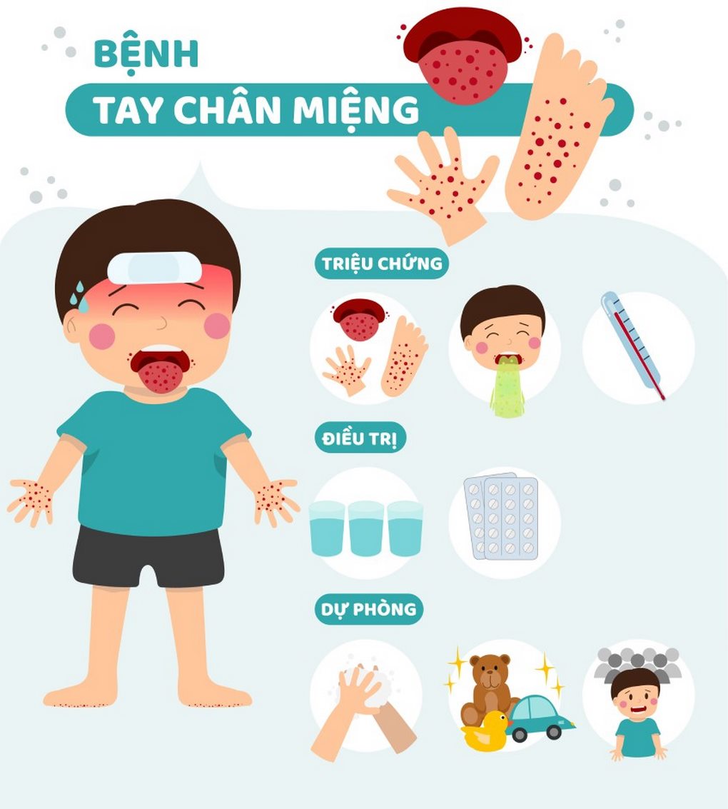 Hình ảnh minh tuyên truyền bệnh tay chân miệng